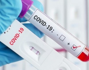 168 са новитe случаи на коронавирус в България показват актуализираните